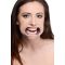   Cheek Retractor Dental Mouth Gag  -  14580